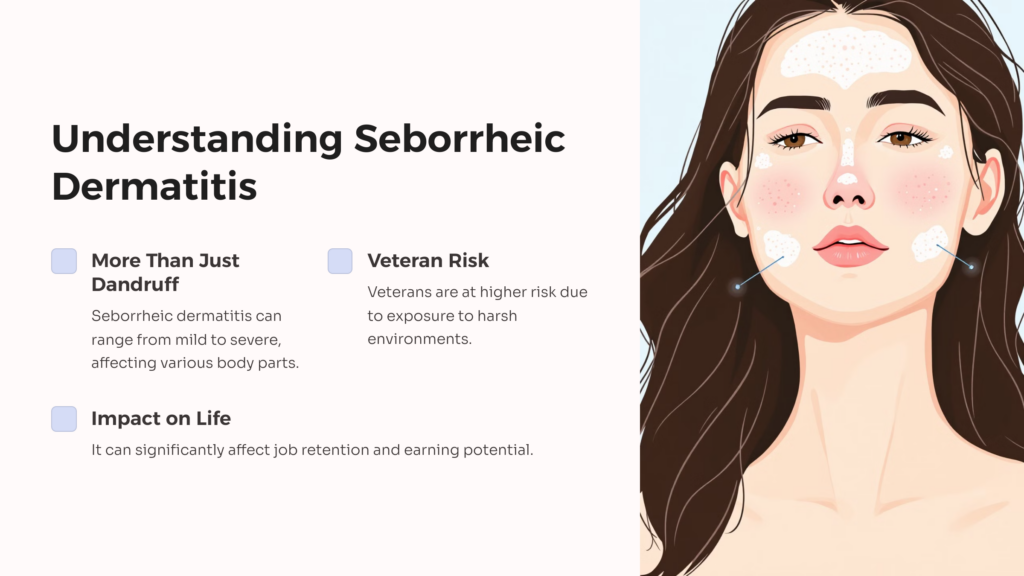 Seborrheic Dermatitis infographic