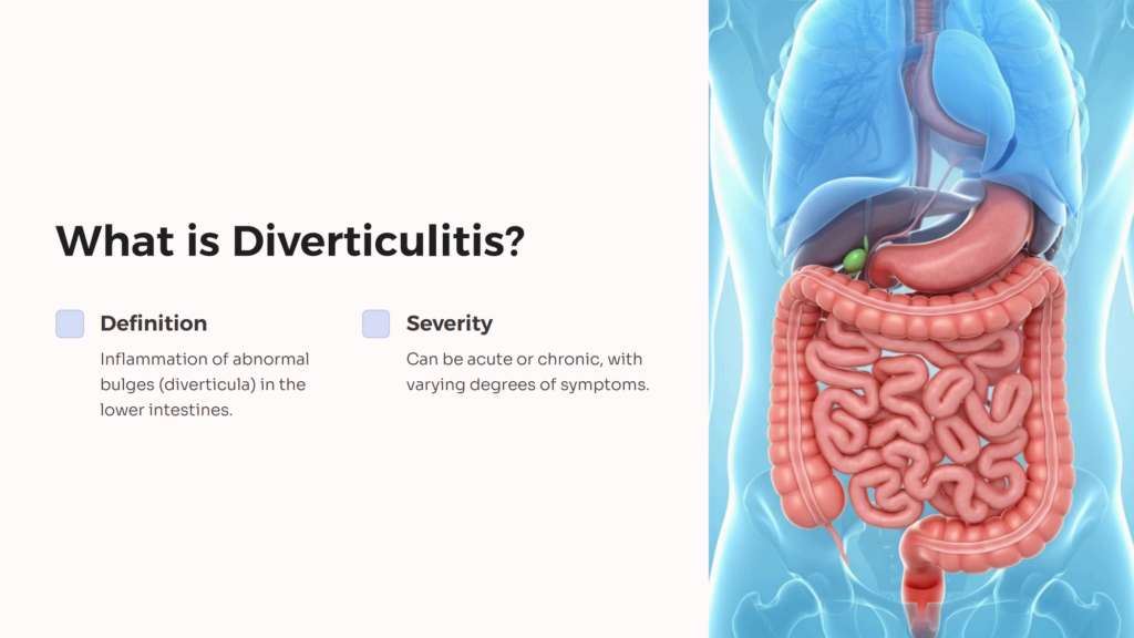 Diverticulitis infographic