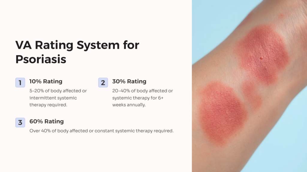 VA Psoriasis Rating infographic